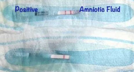 pregnant leaking fluid|Amniotic Fluid: What is It and Signs of Leaking